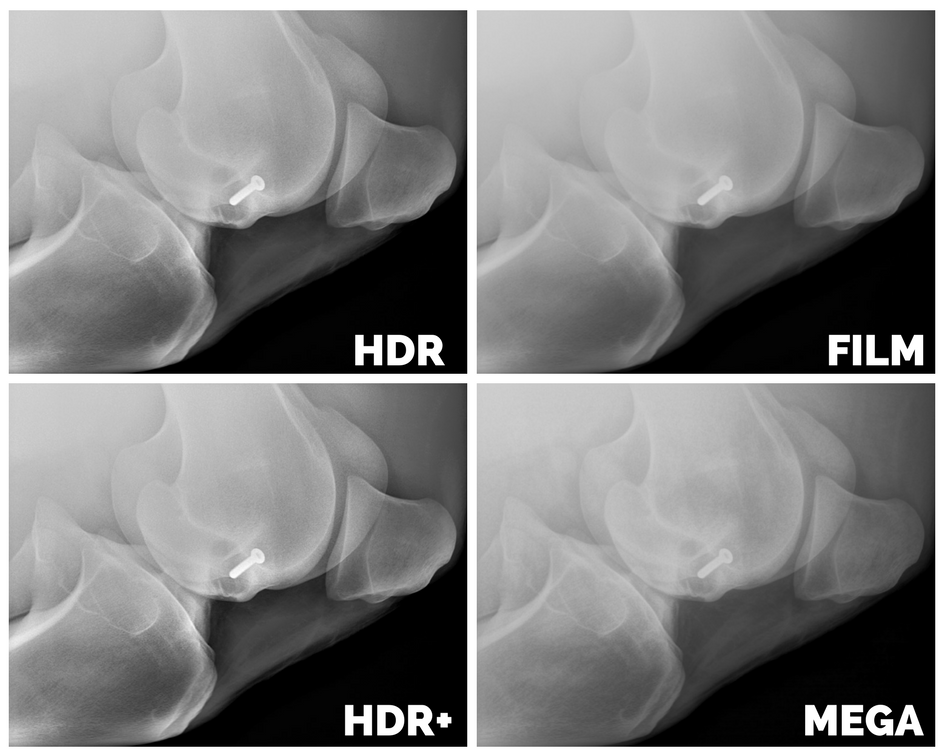 HD digital radiography