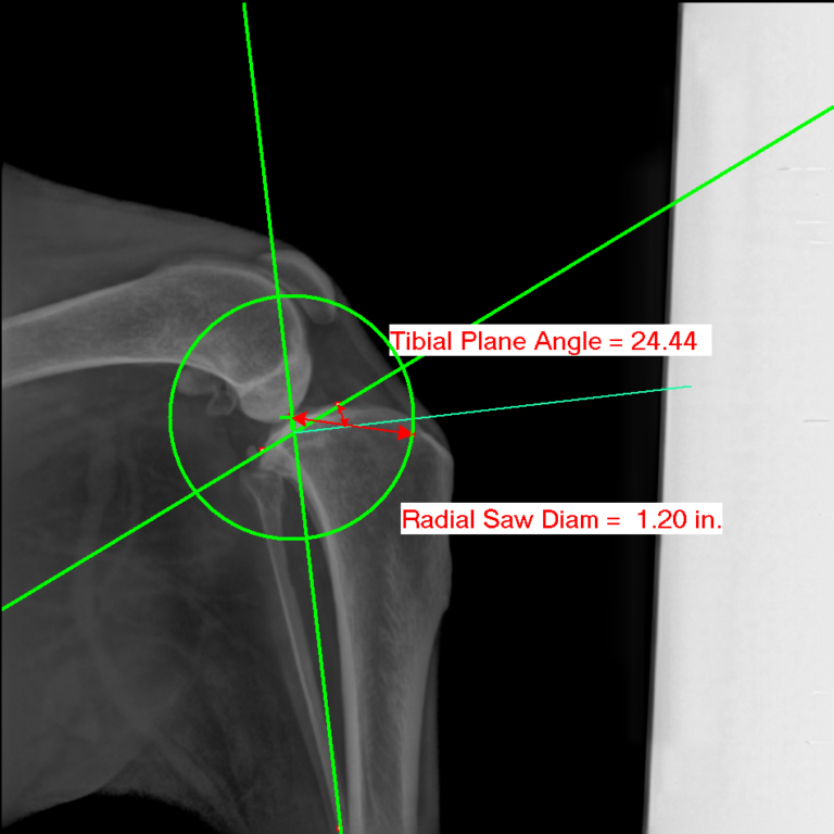 ai-used-to-determine-tplo-measurements-in-vetel-s-metron-software