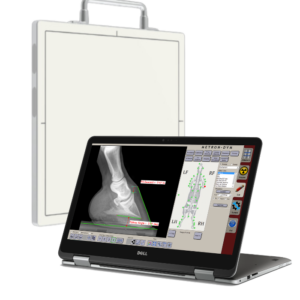 Digital Radiography